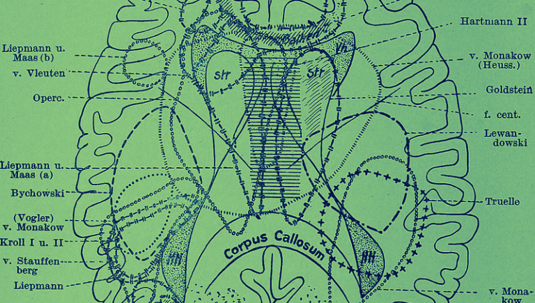 La médicalisation de la folie : comment la schizophrénie a été traitée à travers les âges
